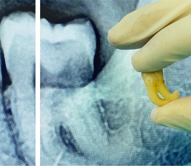 CIRUGÍA MUCOGINGIVAL Y DENTAL