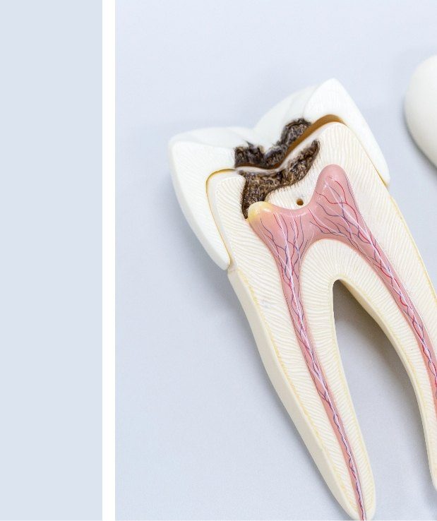 Dentistas Especialistas en endodoncias ourense