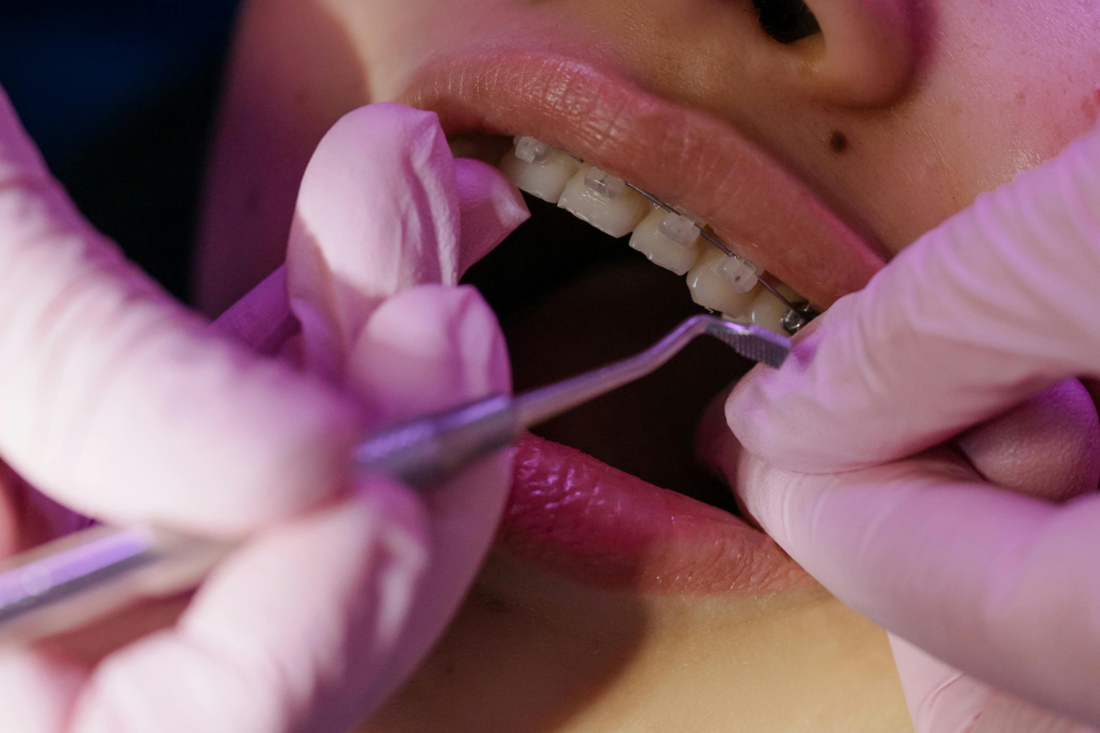 La ortodoncia en Clínica Dental Mora García: mucho más que una sonrisa bonita